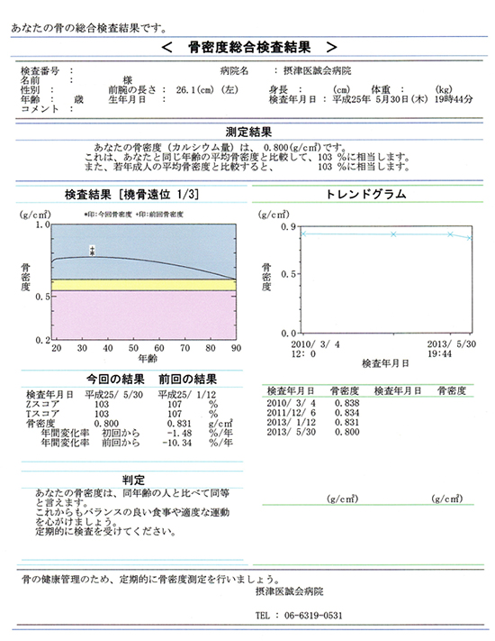 骨密度測定結果用紙（右下に各年齢の平均値のグラフと検査結果を表示しています。）