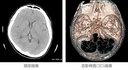 頭部画像・造影検査(3D)画像