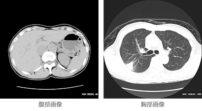 腹部画像・胸部画像
