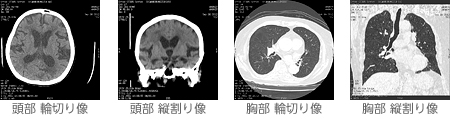 頭部 輪切り像　頭部 縦割り像　胸部 輪切り像　胸部 縦割り像